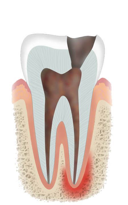 endodonzia1