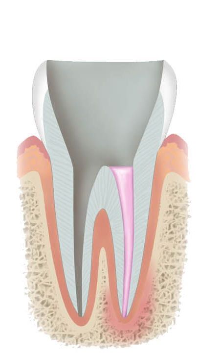 endodonzia3